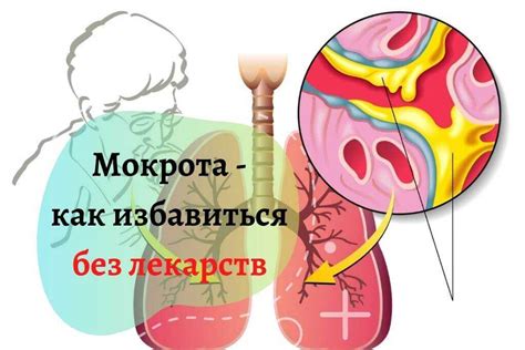 Избавление от мокроты: основные причины и симптомы