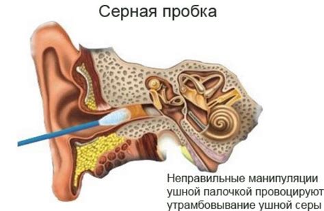 Изменение давления в ушах и возникновение гудков