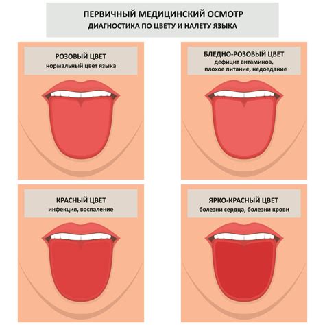 Изменение цвета языка у взрослых: возможные причины