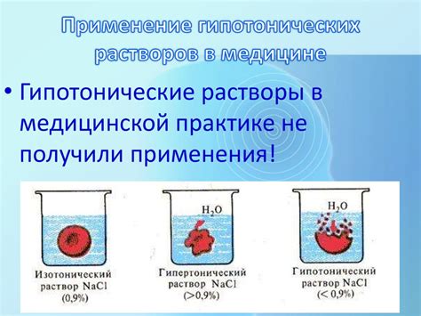 Изотоничные растворы и здоровье организма