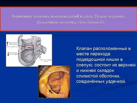 Илеоцекальный клапан в пищеварительной системе