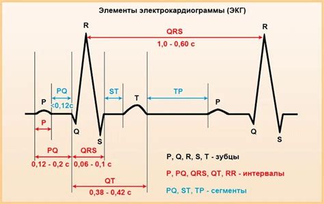 Интервал QRS в электрокардиографии