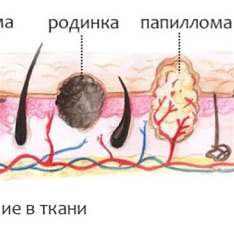 Интерпретация родинки около губы