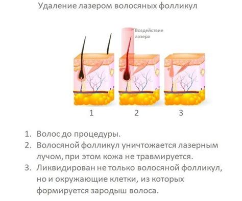 Интерпретация снов о удалении волос с ног и желании выглядеть привлекательно