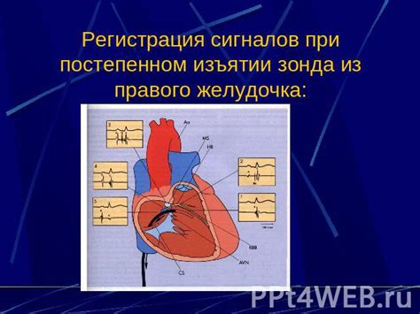 Интерпретация электрической активности сердца