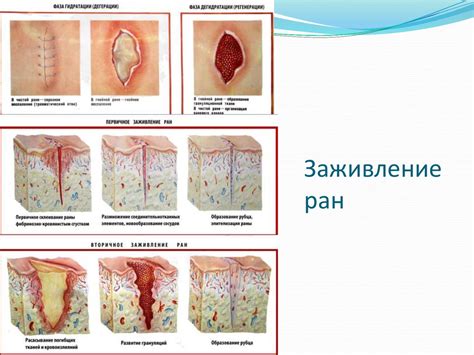 Инфекция и воспаление