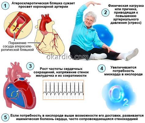 Ишемия сердца приводит к кислородному дефициту организма