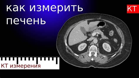 КТ и МРТ для определения уплотнения печени