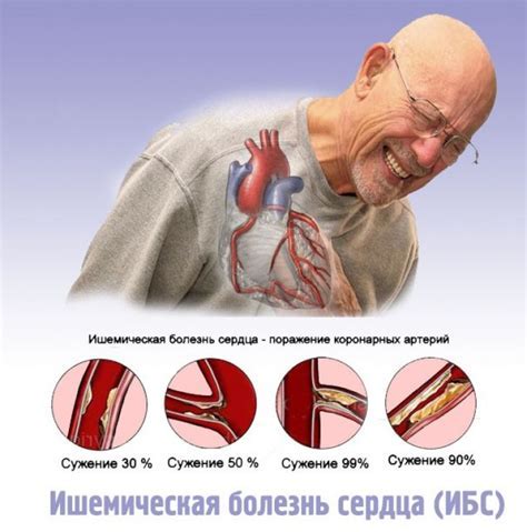 Какая роль играет повышенный показатель QRS в диагностике?