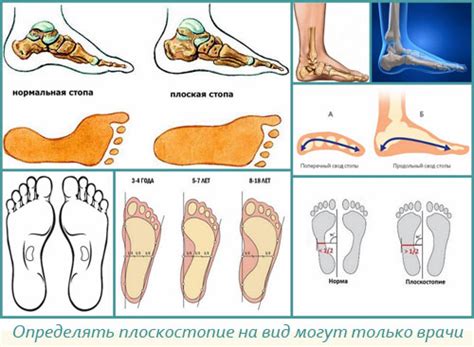 Какие виды лечения существуют для комбинированного плоскостопия?