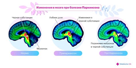 Какие изменения можно обнаружить?