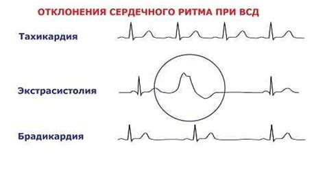 Какие методы используются для диагностики ВСД по кардиологическому типу?