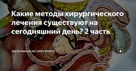 Какие методы лечения существуют