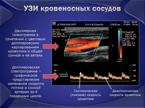 Какие показания для проведения УЗИ БСА?