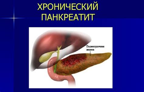 Какие последствия могут быть при коде 25 при флюорографии?