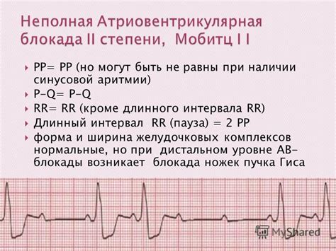 Какие последствия могут быть при электрической альтернации желудочковых комплексов