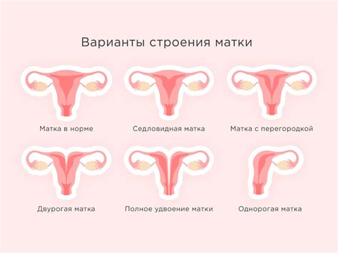 Какие предосторожности принять, если повторяется сон о спущении матки и на что обратить внимание