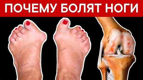 Какие причины могут вызывать унос ног?