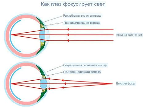 Какие проблемы вызывает миопия 1 степени глаза?