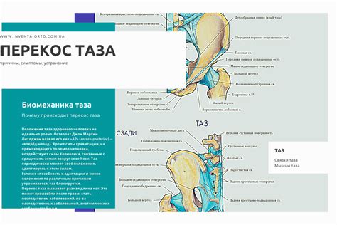 Какие симптомы возникают при перекосе таза?