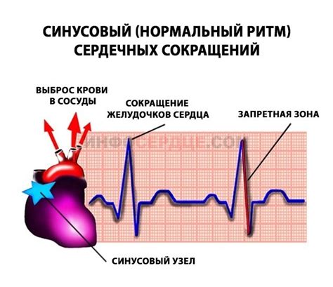 Какие симптомы и признаки сопровождают блокаду на кардиограмме?