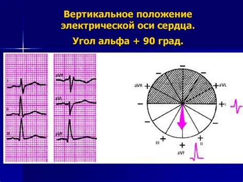 Какие симптомы могут указывать на девиацию электрической оси сердца?