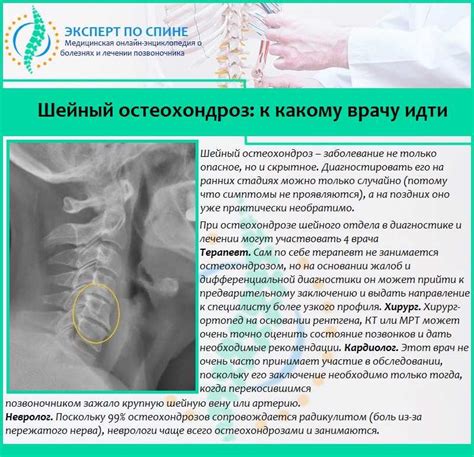 Какие симптомы свидетельствуют о нестабильности шейного позвонка?