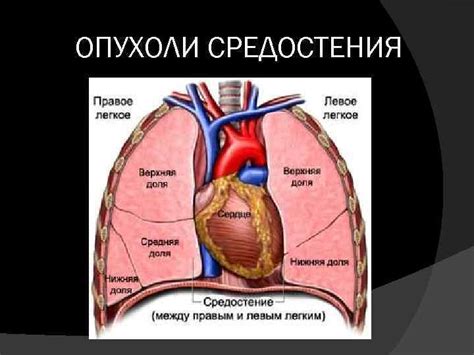 Какие симптомы связаны с третьей стадией опухоли?