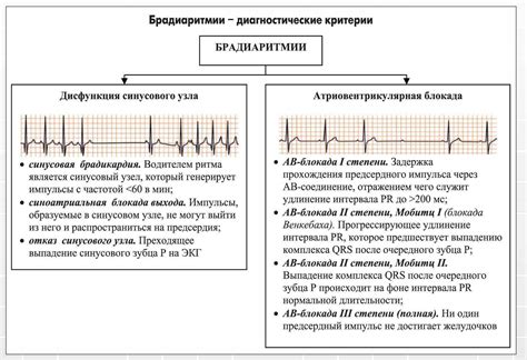 Какие симптомы сопровождают легкую синусовую аритмию у детей?