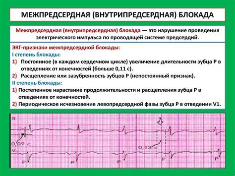 Какие симптомы сопровождают нарушения желудочковой проводимости?