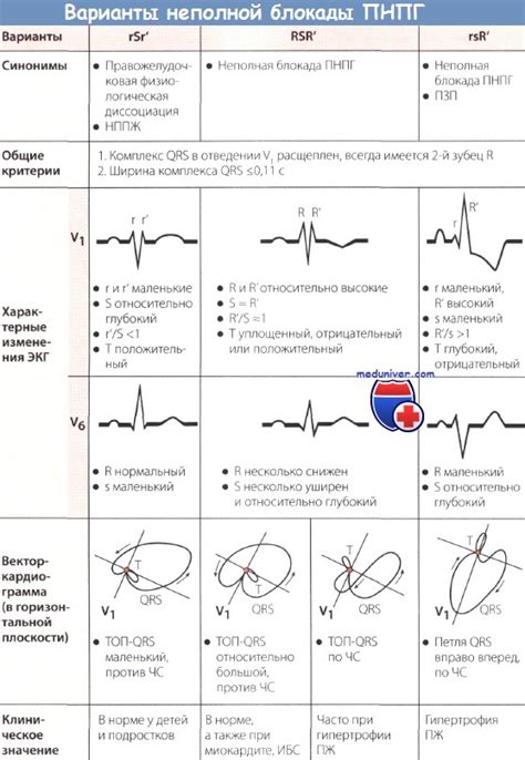 Какие симптомы сопровождают неполную блокаду ПНПГ при ЭКГ у ребенка?