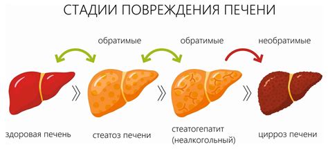 Какие существуют типы эхопризнаков печени