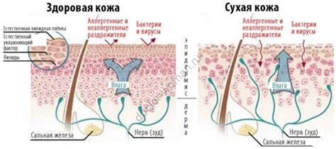 Какие условия вредят обезвоженной коже