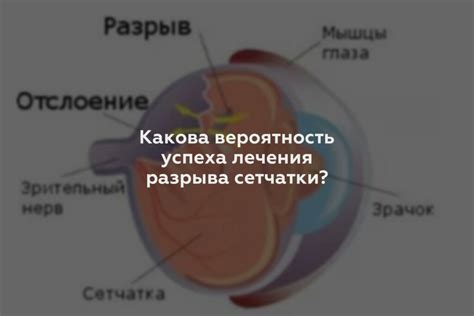 Какими методами можно лечить разрывы сетчатки?