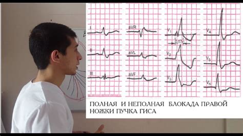 Каким образом работает блока ножки ГИСА