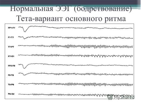 Каковы последствия основного ритма дезорганизован ЭЭГ?