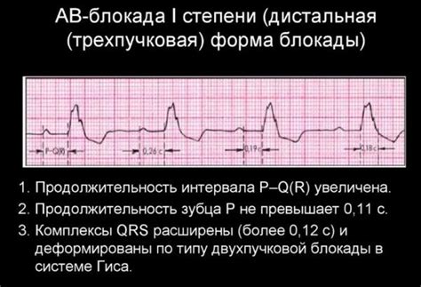 Каковы причины возникновения транзиторной ав блокады 1 степени?