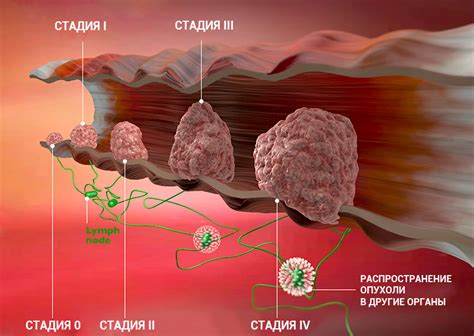 Как возникает положительная динамика при раке?