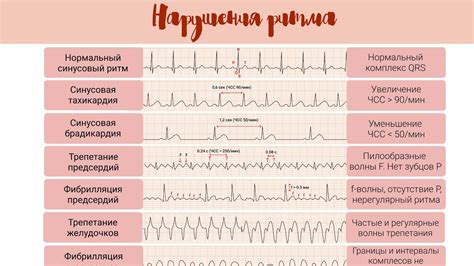 Как выполняется ЭКГ и измеряется показатель QRS?