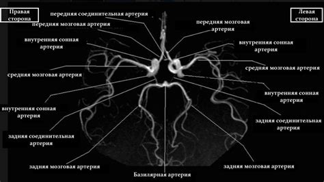 Как диагностировать замкнутый круг Виллизиева головного мозга?