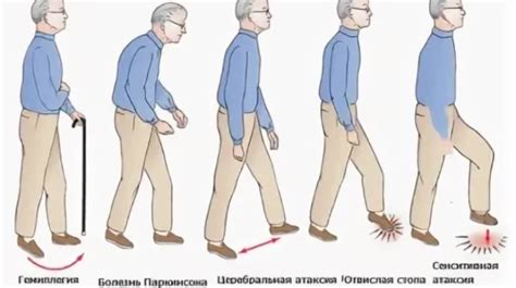 Как диагностировать нарушение координации движений