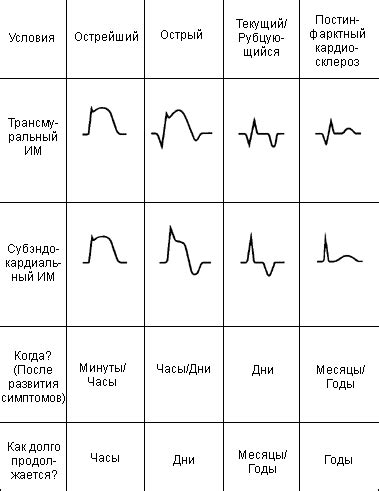 Как интерпретировать кардиограмму?