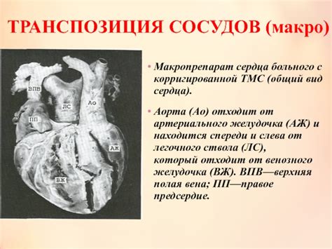 Как исправить проблемы с трикуспидальным клапаном?