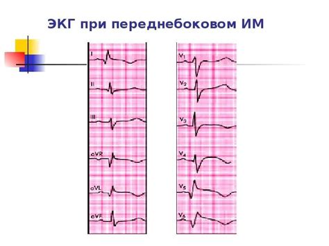 Как лечить выявленные при патологической ЭКГ заболевания?