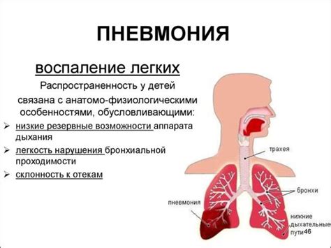 Как лечить нео процесс в легких?