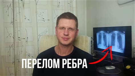 Как лечить эндостоз ребра?