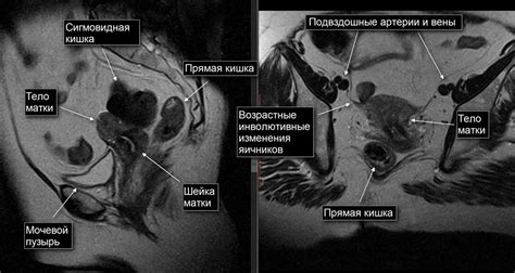 Как образование малого таза у женщин влияет на их здоровье?