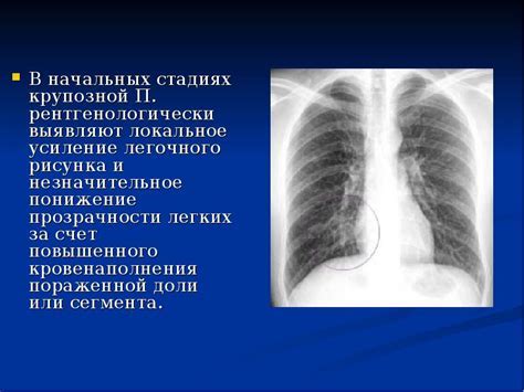 Как определить возрастную норму при флюорографии