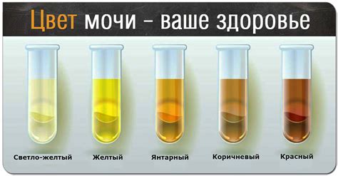 Как пищевые привычки могут влиять на цвет мочи?