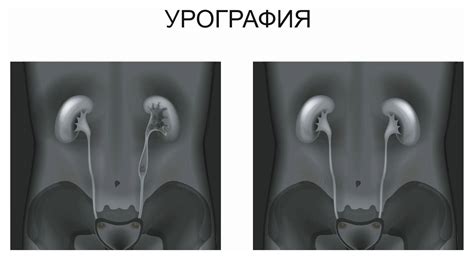 Как понять результаты С УЗИ 5 отверстий?